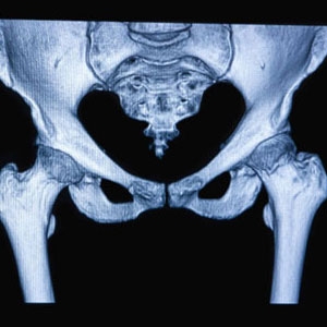 Hip Surgeon New York: Top Hip Replacement Trends Every Patient Should Watch in 2026