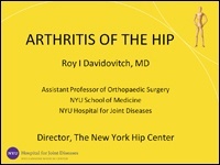 Hip Arthritis pic